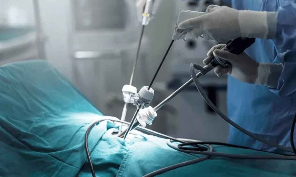 عکس جراحی سرطان معده به روش لاپاراسکوپی پیشرفته