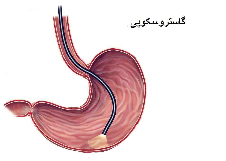 گاستروسکوپی تشخیصی
