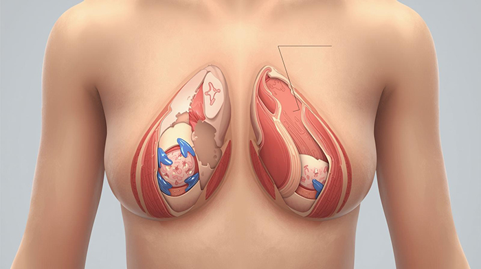 مسیر بهبودی پس از جراحی: مراقبت‌های دلسوزانه و جامع