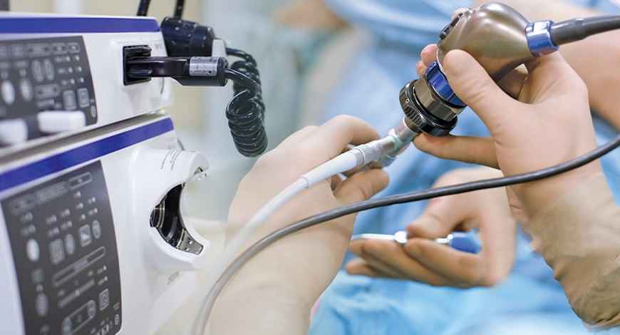 آندوسکوپی سرطان معده و جواب آن